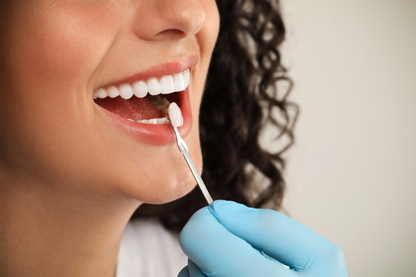 Are Dental Veneers Right For You? Explore Your Options