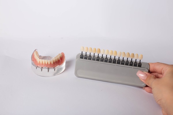 Implant Supported Dentures: Can They Successfully Replace Upper Teeth?