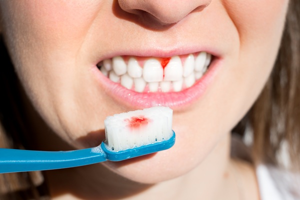 The Importance Of Periodontal Gum Disease Treatment